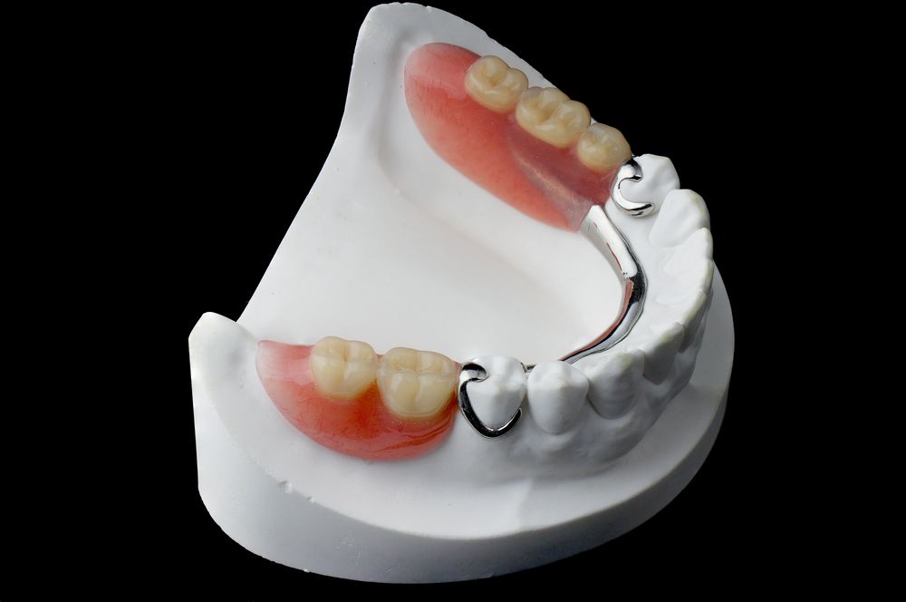 How Long Does it Take Ace Dental to Make Dentures?