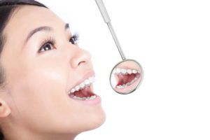 Woman smiling with a dental mirror in front of her mouth