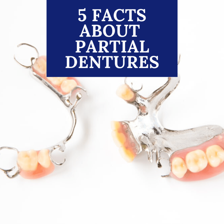 5 Facts About Partial Dentures