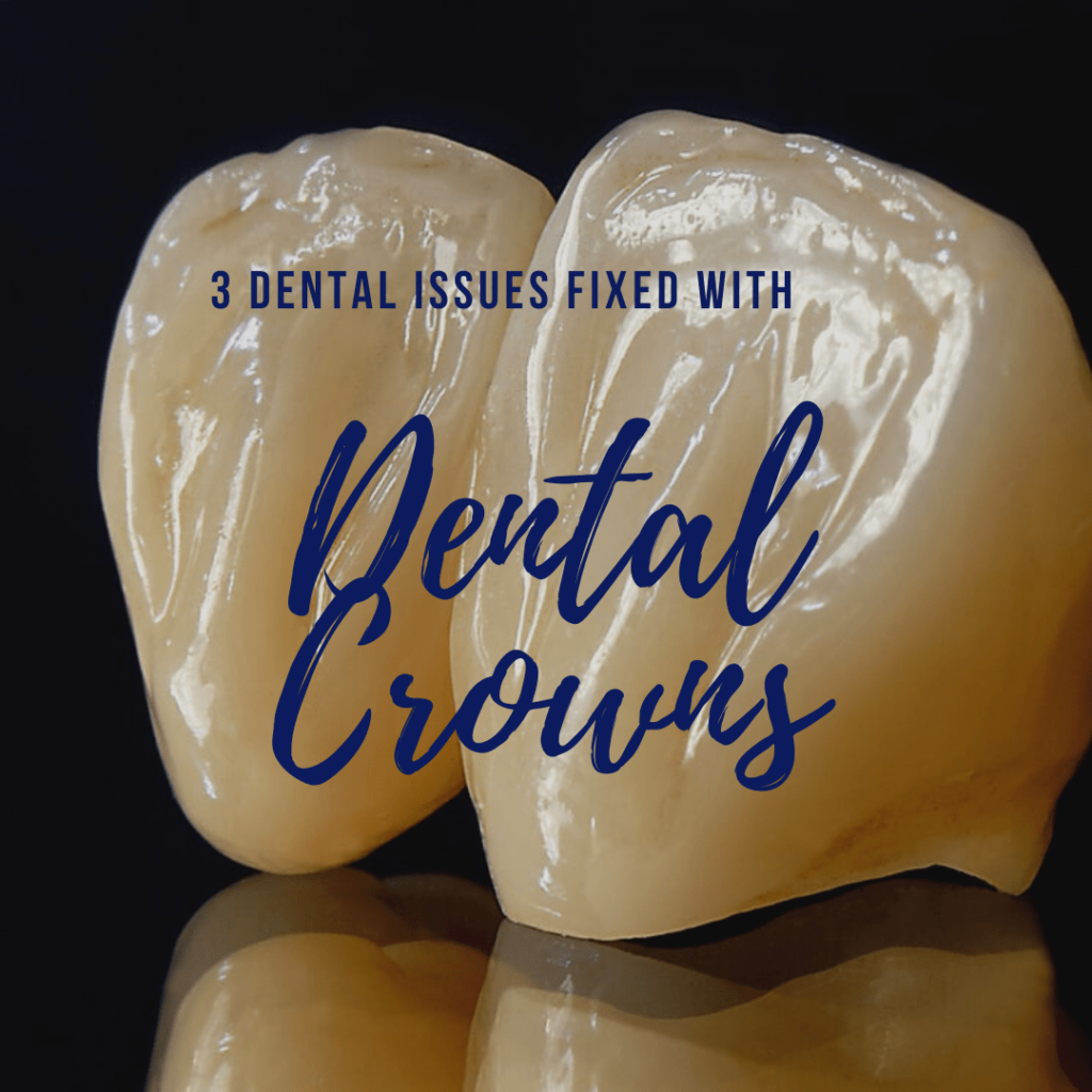 3 Dental Issues Fixed with Dental Crowns