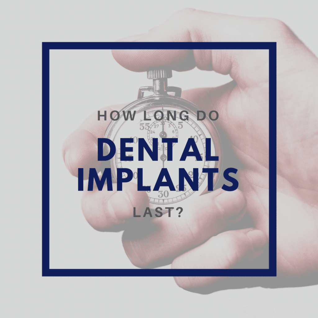 _ How Long Do Dental Implants Last