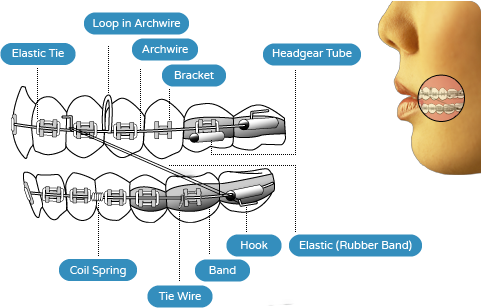 Orthodontic elastics springs coils and hooks