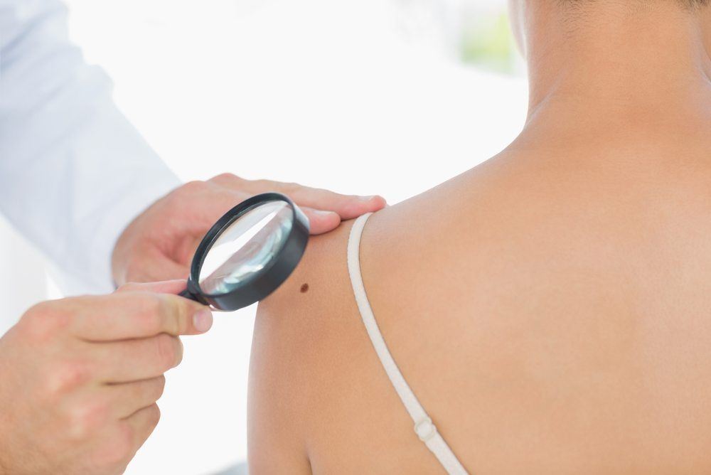 Doctor Examining a womans skin with a magnifying glass for Melanoma