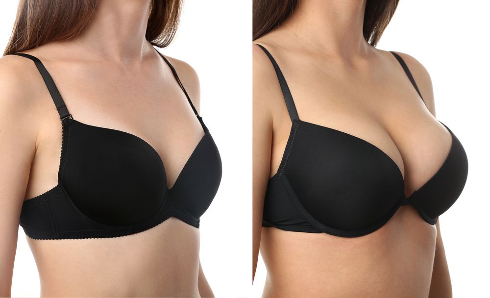 affordable breast augmentation