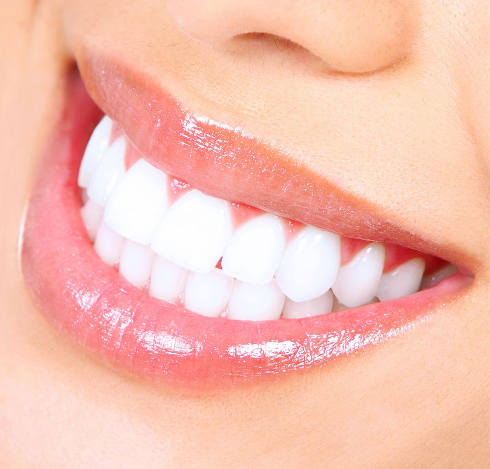 Productiviteit Aantrekkingskracht fusie Teeth Whitening in Spotswood, NJ - Dental Visions Family Dentistry